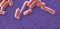 Cada ao mueren en el mundo varias decenas de personas a causa de la infeccin por cepas verotoxignicas de la bacteria Escherichia coli